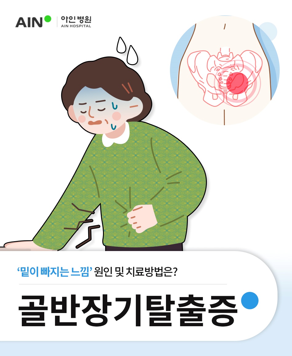 골반장기탈출증 밑이 빠지는 느낌 원인, 아인병원 치료방법