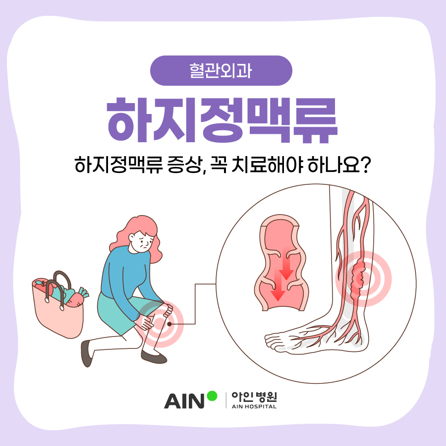 주안하지정맥류 증상 꼭 치료해야 하나요?