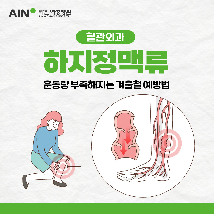 하지정맥류 운동량 부족해지는 겨울철 예방법