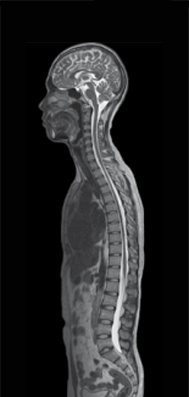 전신척추 촬영사진