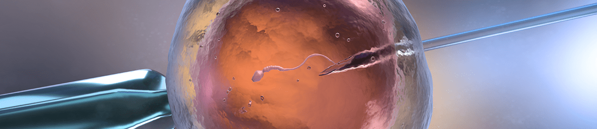 인공수정클리닉 진료 이미지