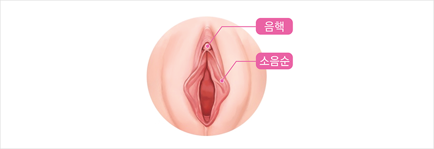 소음순 + 음핵 동시 수술