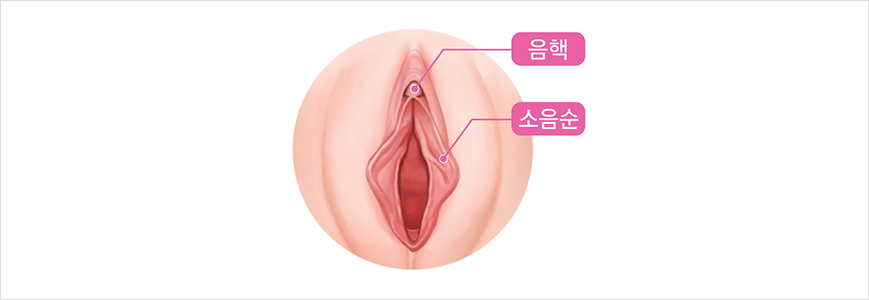소음순 + 음핵 동시 수술